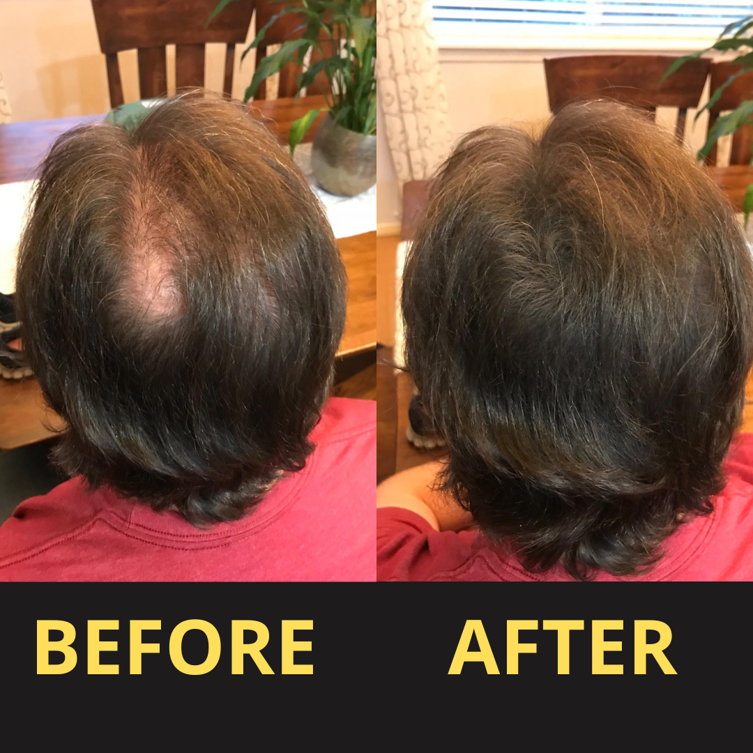 Hairfillup Hair Concealer BLACK 50ML - Waterproof 3–7 days.