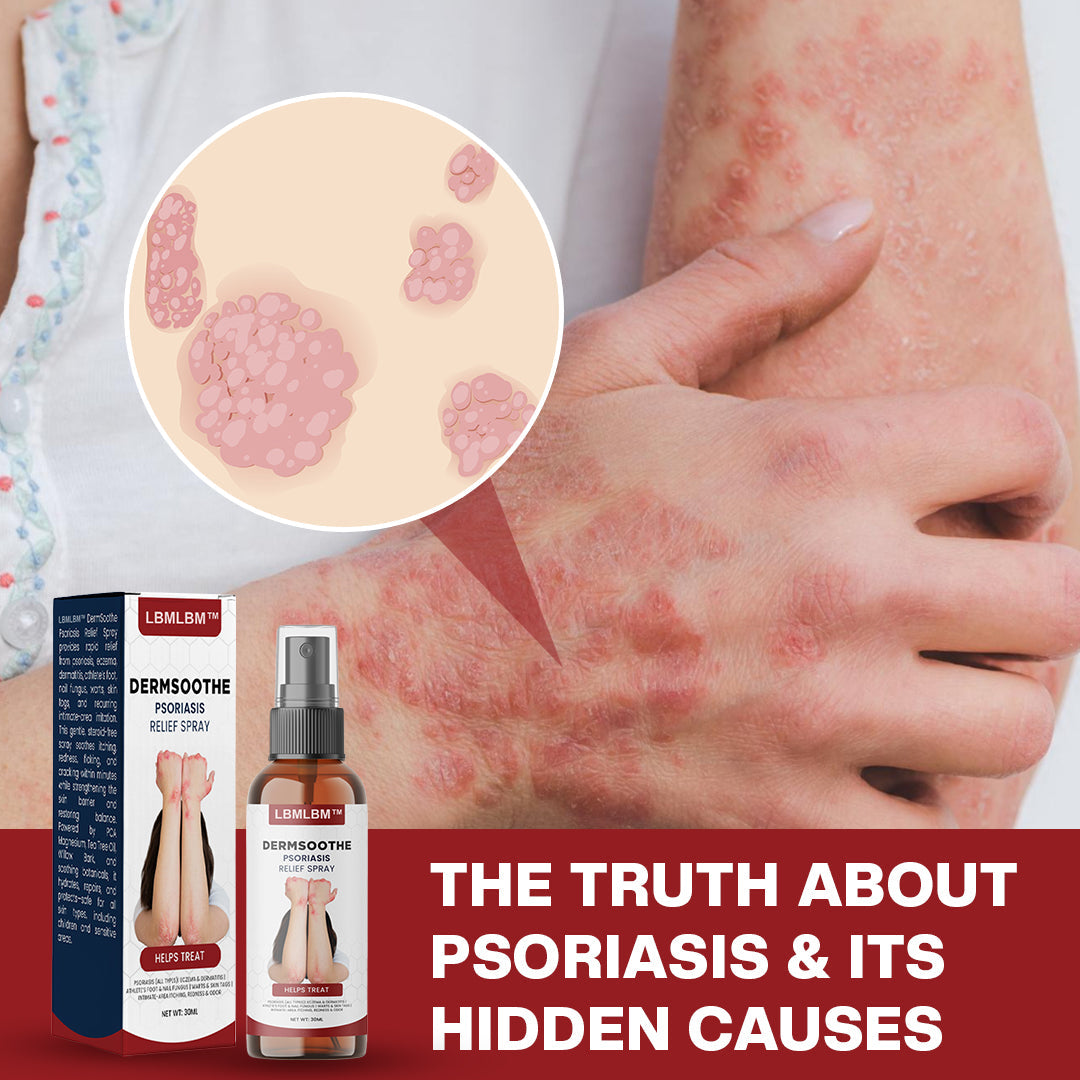 【Last Day Promotion 80% OFF🔥】 DermSoothe Psoriasis Relief Spray🇺🇸👨⚕️(Zero Itch, 3-Min Relief | 99.5% Skin Recovery Rate | All-Natural, 24/7 Repair | )🔥🎁