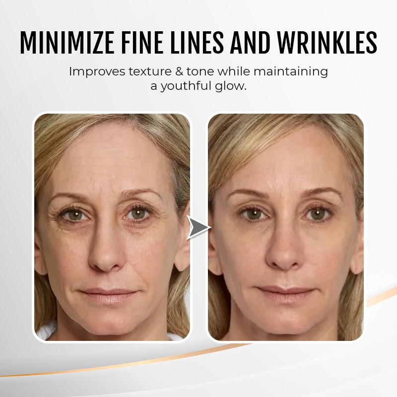 🔥 Last Day Discount: 87% OFF💐Instant Wrinkle Eye Tightener cream