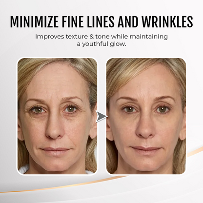 🔥 Last Day Discount: 87% OFF💐Instant Wrinkle Eye Tightener cream