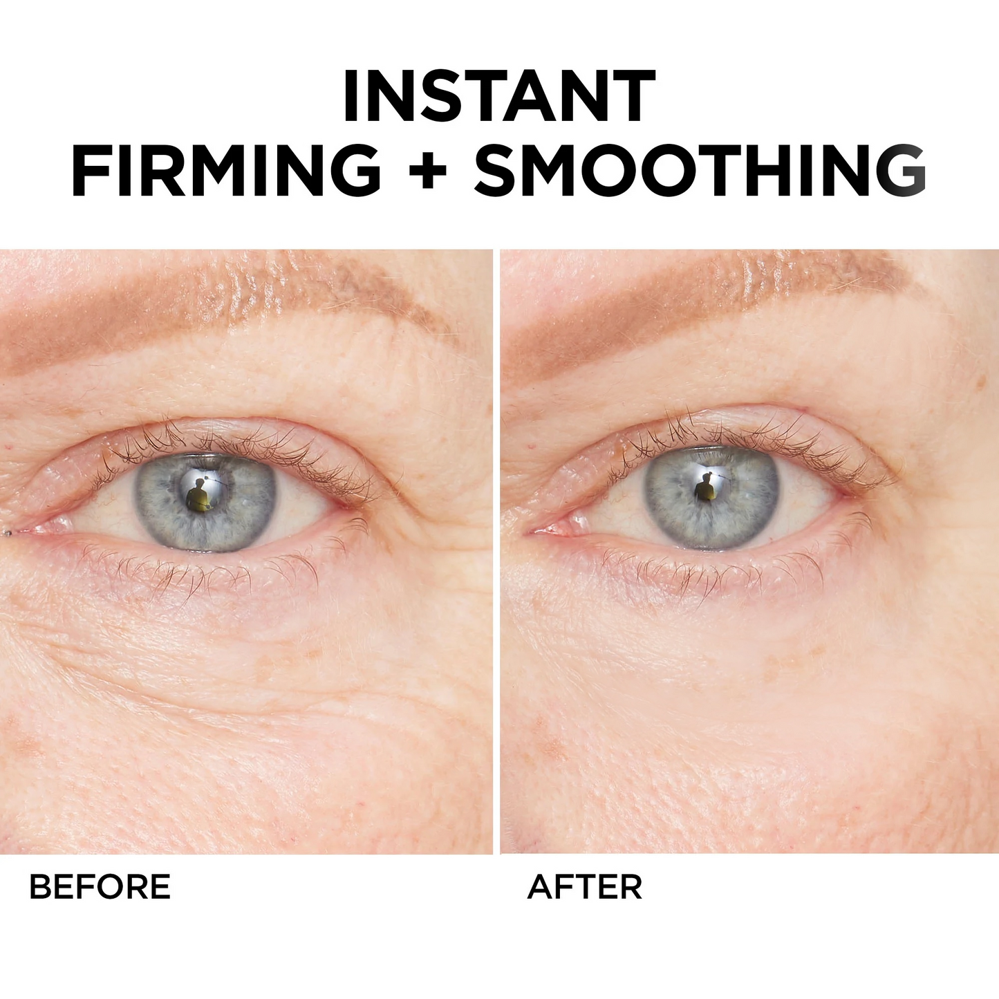 🔥 Last Day Discount: 87% OFF💐Instant Wrinkle Eye Tightener cream