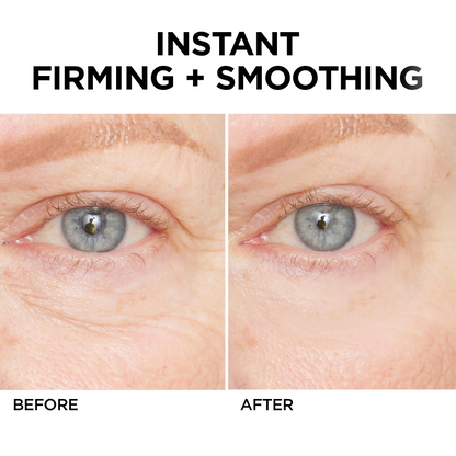 🔥 Last Day Discount: 87% OFF💐Instant Wrinkle Eye Tightener cream