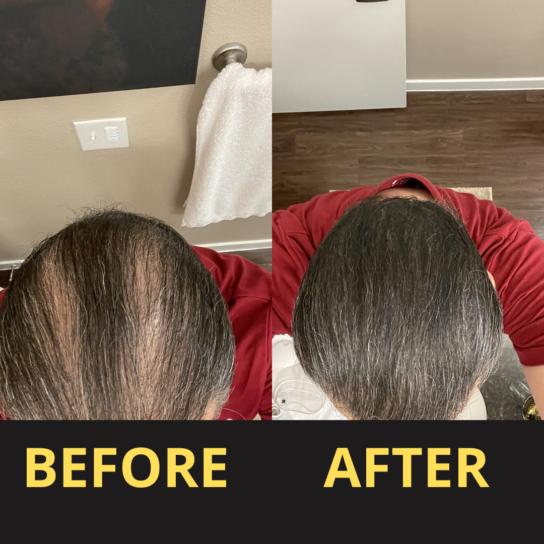 Hairfillup Hair Concealer BLACK 50ML - Waterproof 3–7 days.