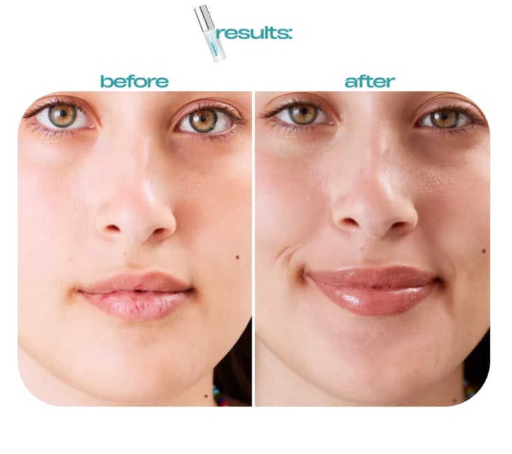 🔥 Last Day 51% OFF✨BBOJI™BP Spicule Plumping Lip Shot