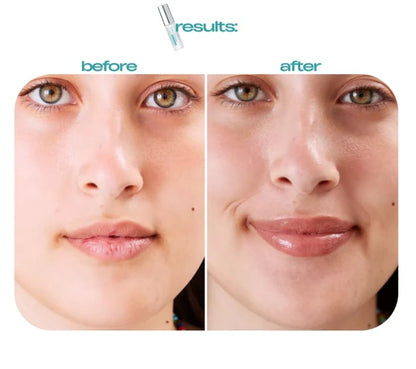 🔥 Last Day 51% OFF✨BBOJI™BP Spicule Plumping Lip Shot