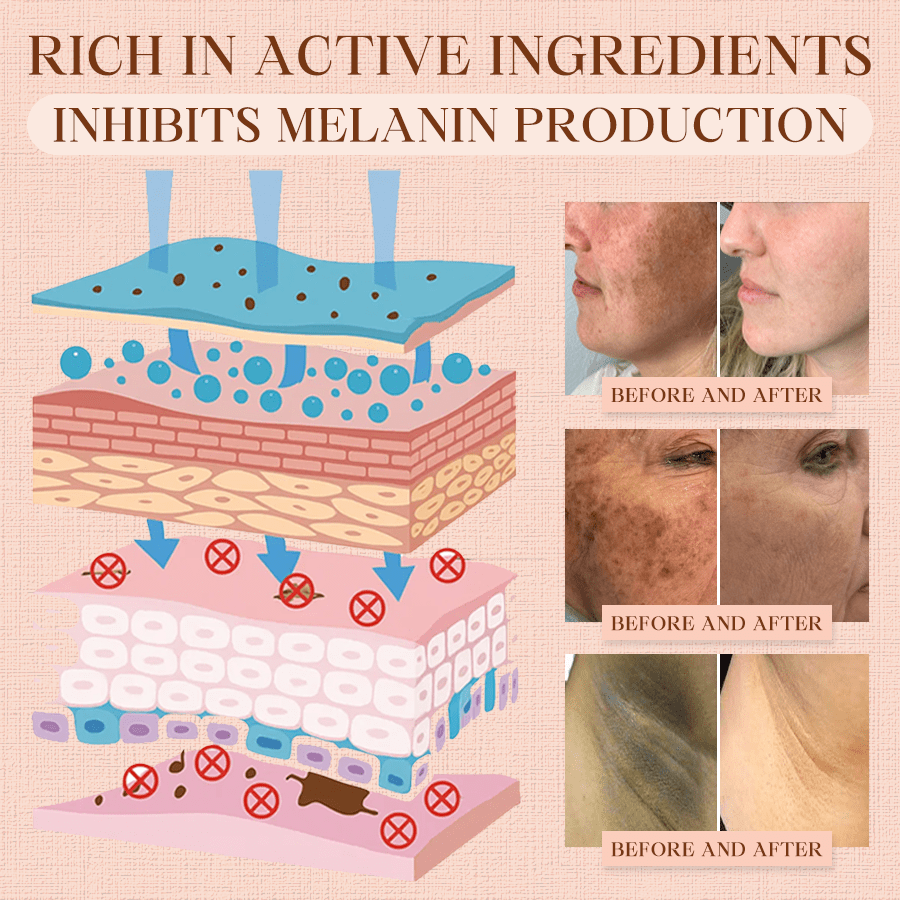 NEENCE® Purifying Exfoliating Gel for Acanthosis Nigricans, Exfoliation, Dark Spots, Skin Tags, and Eczema_Ultra01