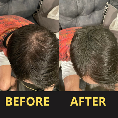 Hairfillup Hair Concealer BLACK 50ML - Waterproof 3–7 days.