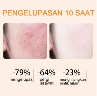 🔥Orange Enzyme Exfoliating Gel — The Gentle Miracle Your Skin Has Been Crying Out For