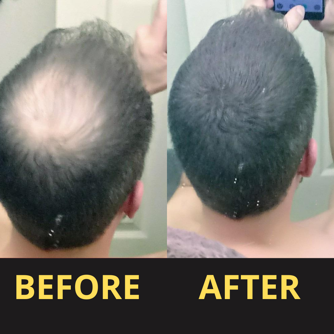 Hairfillup Hair Concealer BLACK 50ML - Waterproof 3–7 days.