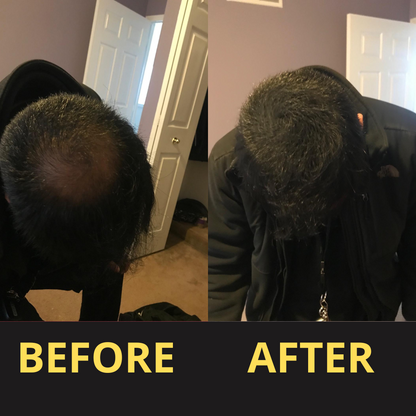 Hairfillup Hair Concealer BLACK 50ML - Waterproof 3–7 days.