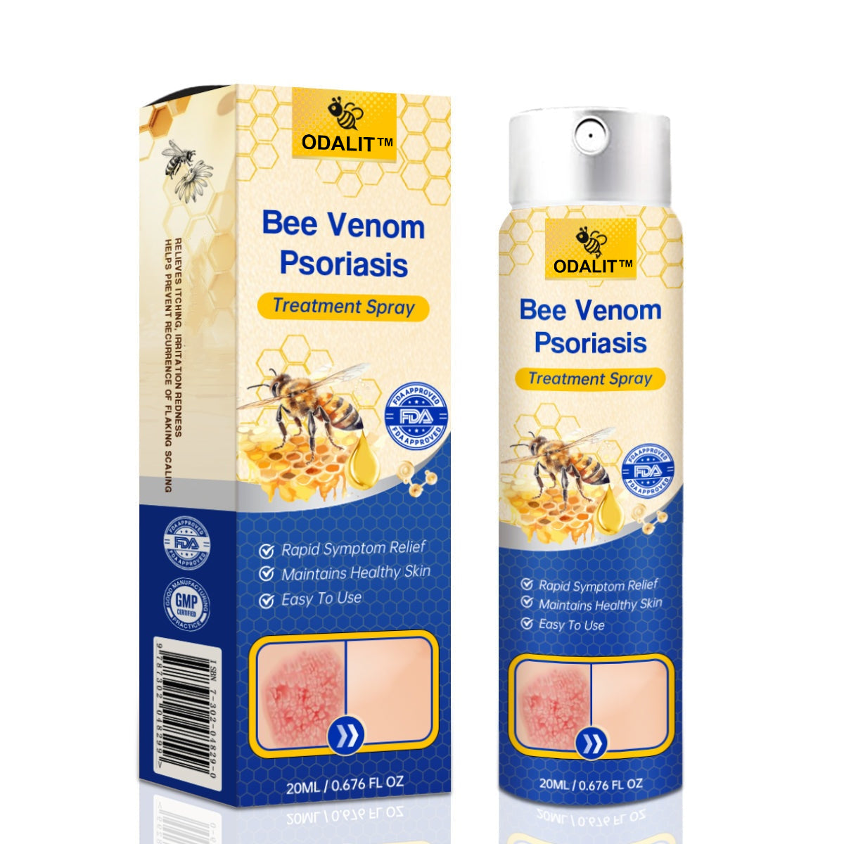 ODALIT™ PsoriaHeal Bee Venom Psoriasis Treatment Spray pro