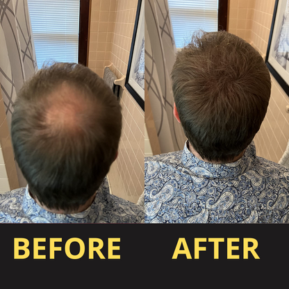 Hairfillup Hair Concealer BLACK 50ML - Waterproof 3–7 days.