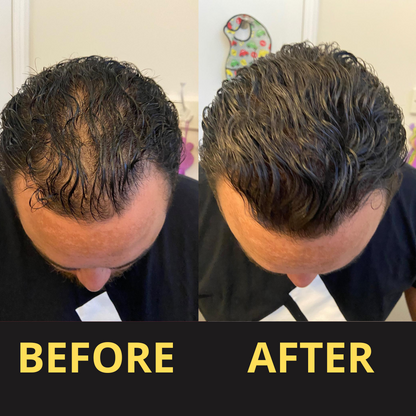 Hairfillup Hair Concealer BLACK 50ML - Waterproof 3–7 days.