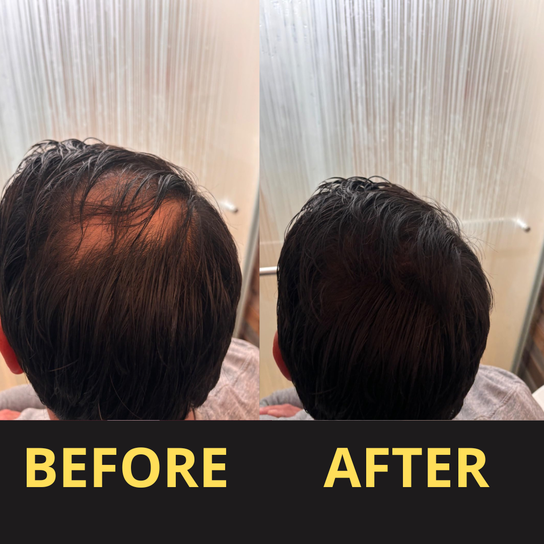 Hairfillup Hair Concealer BLACK 50ML - Waterproof 3–7 days.