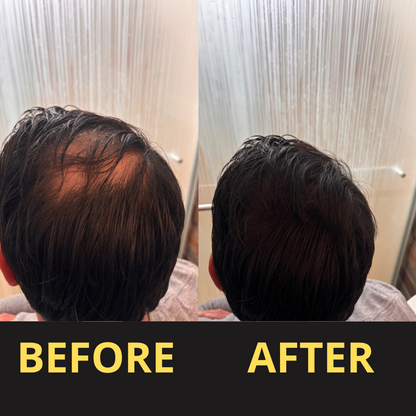 Hairfillup Hair Concealer BLACK 50ML - Waterproof 3–7 days.