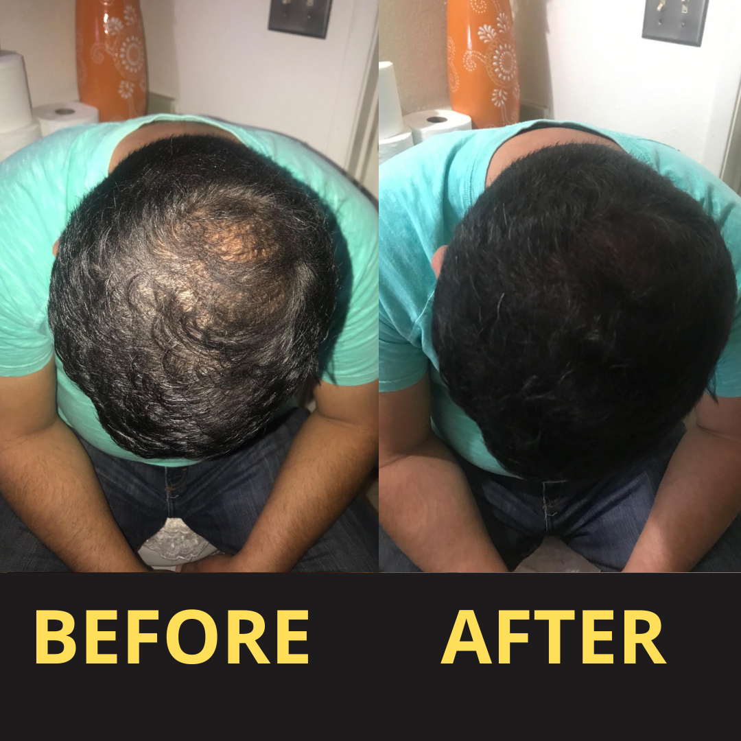 Hairfillup Hair Concealer BLACK 50ML - Waterproof 3–7 days.