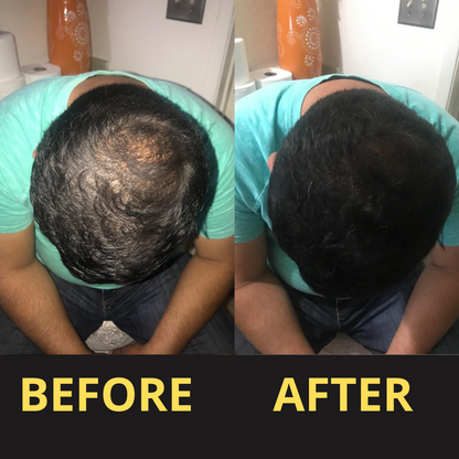 Hairfillup Hair Concealer BLACK 50ML - Waterproof 3–7 days.