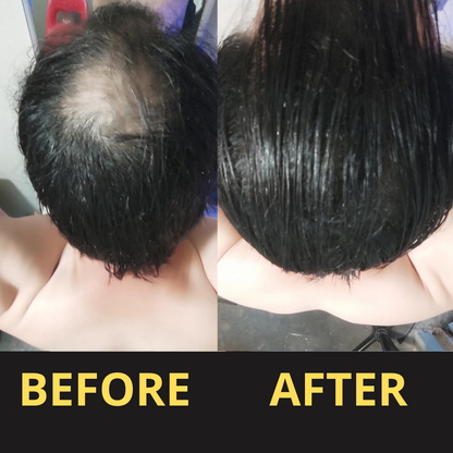 Hairfillup Hair Concealer BLACK 50ML - Waterproof 3–7 days.