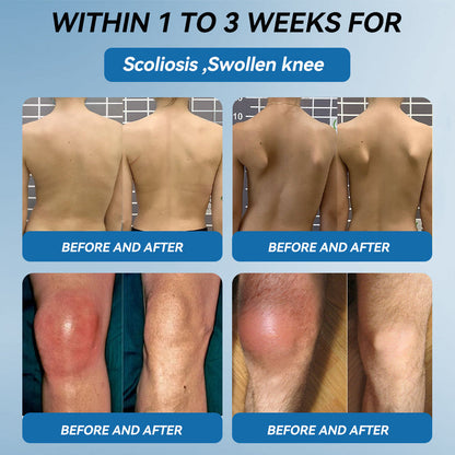 Juxek™ BPC-157 Joint Healing Cream 🦴Treats Arthritis, Neuropathy, Rheumatism, Sports Injuries & More👍