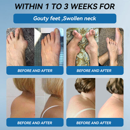 Juxek™ BPC-157 Joint Healing Cream 🦴Treats Arthritis, Neuropathy, Rheumatism, Sports Injuries & More👍