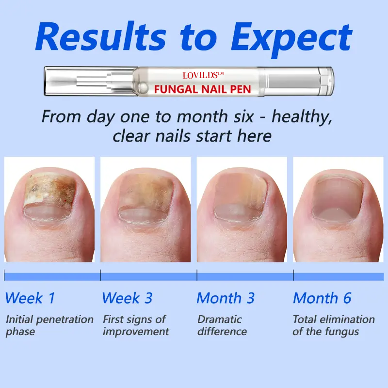 Nail Pen with Allicin & Undecylenic Acid, Nail Health Care Pen, Nail Fungus Care Pen for Solving Fungal Nails and Other Nail Problems,