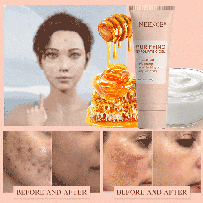 NEENCE® Purifying Exfoliating Gel for Acanthosis Nigricans, Exfoliation, Dark Spots, Skin Tags, and Eczema_Ultra01