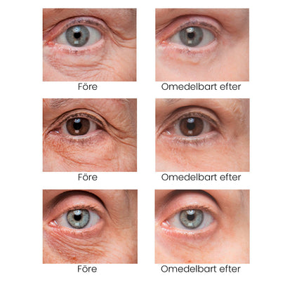 🔥Last 3 hours discount:BrightUp - Omedelbar Eye Tightener