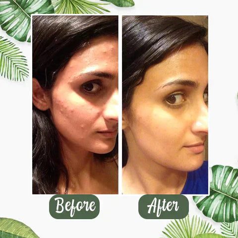 🔥Green Tea Green Tea Mask🔥