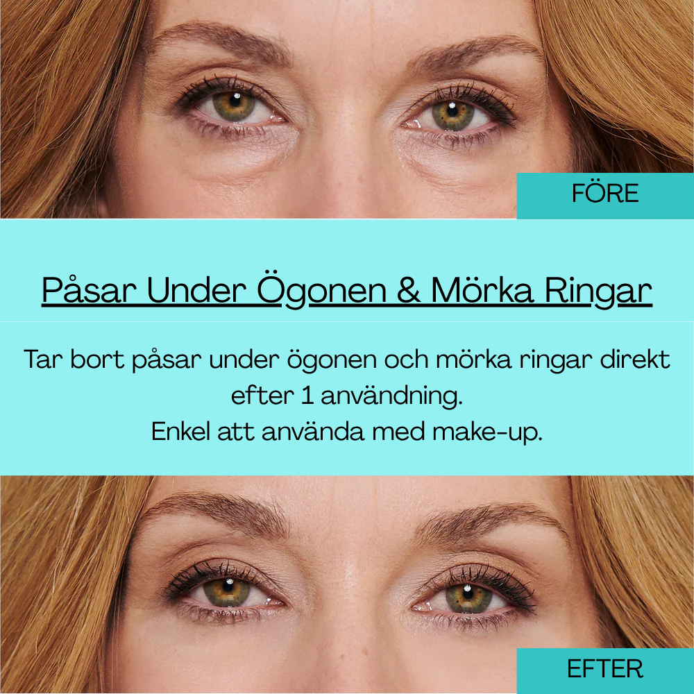 🔥Last 3 hours discount:BrightUp - Omedelbar Eye Tightener