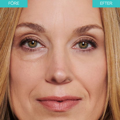 🔥Last 3 hours discount:BrightUp - Omedelbar Eye Tightener