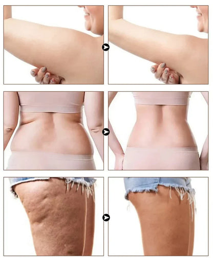 Final 3 Hours: 60%OFF🔥Naturals Cellulite Massage Oil