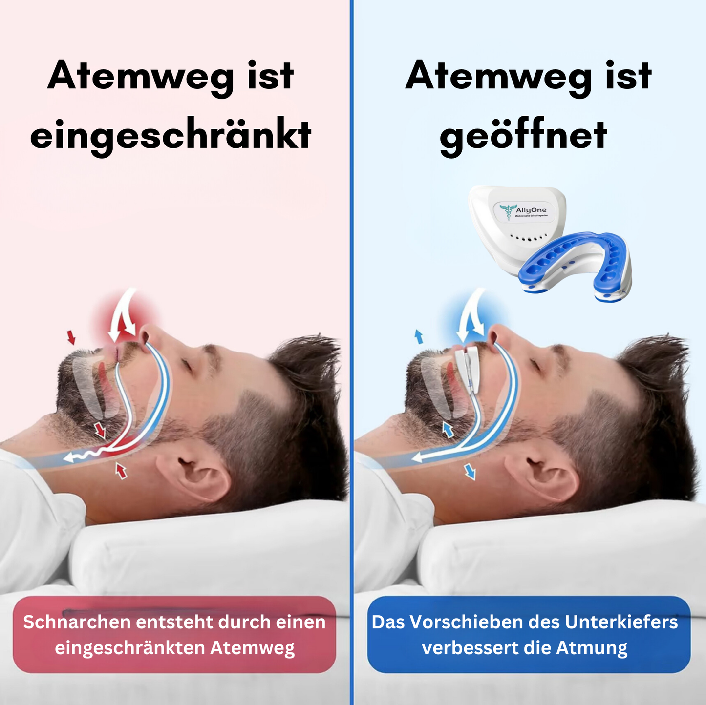 🌸 All-in-One Anti-Schnarch-Schiene (Zahnschutz)