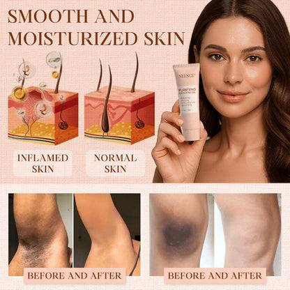 NEENCE® Purifying Exfoliating Gel for Acanthosis Nigricans, Exfoliation, Dark Spots, Skin Tags, and Eczema_Ultra01