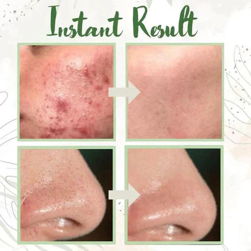 🔥Green Tea Green Tea Mask🔥