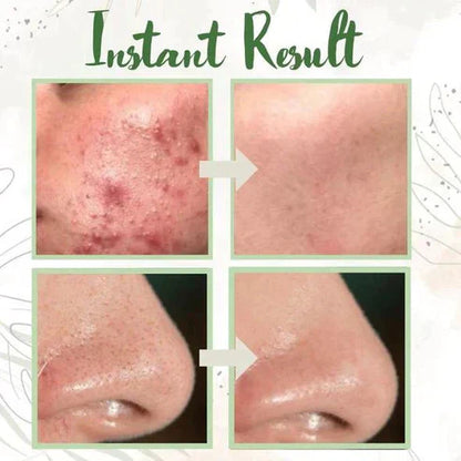 🔥Green Tea Green Tea Mask🔥