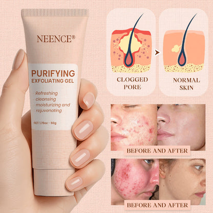 NEENCE® Purifying Exfoliating Gel for Acanthosis Nigricans, Exfoliation, Dark Spots, Skin Tags, and Eczema_Ultra01